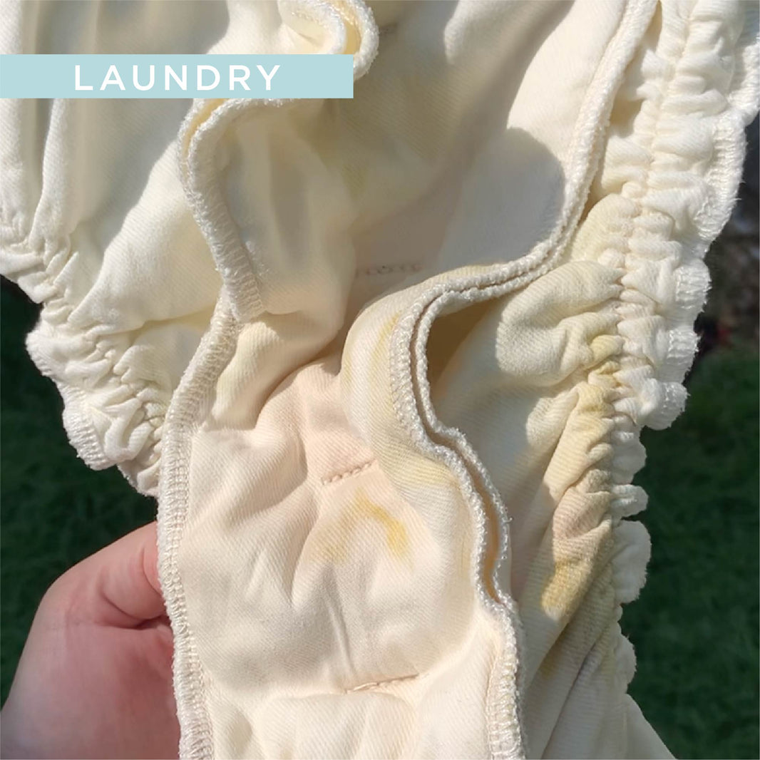 The Diaper Staining Guide: A Simple Way to Assess Cloth Diaper Stains and How to Treat Them